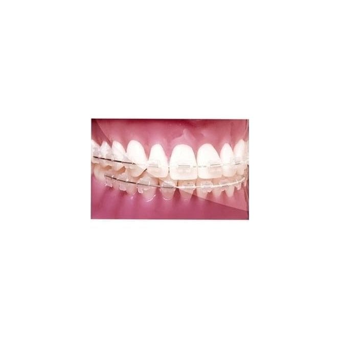 O/Quest Archwire .016 Upper Ni/Ti Tooth Coloured - Pack10